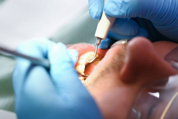 Best Pediatric Emergency Dentist in Queen Anne, MD