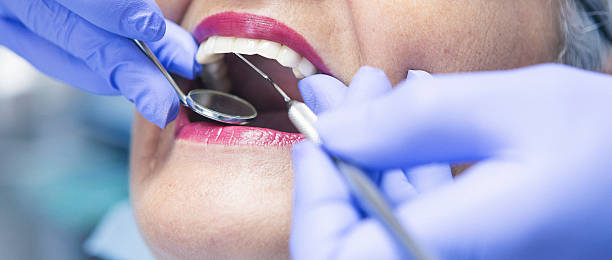Best Emergency Dentist for Lost Fillings or Crowns in Queen Anne, MD